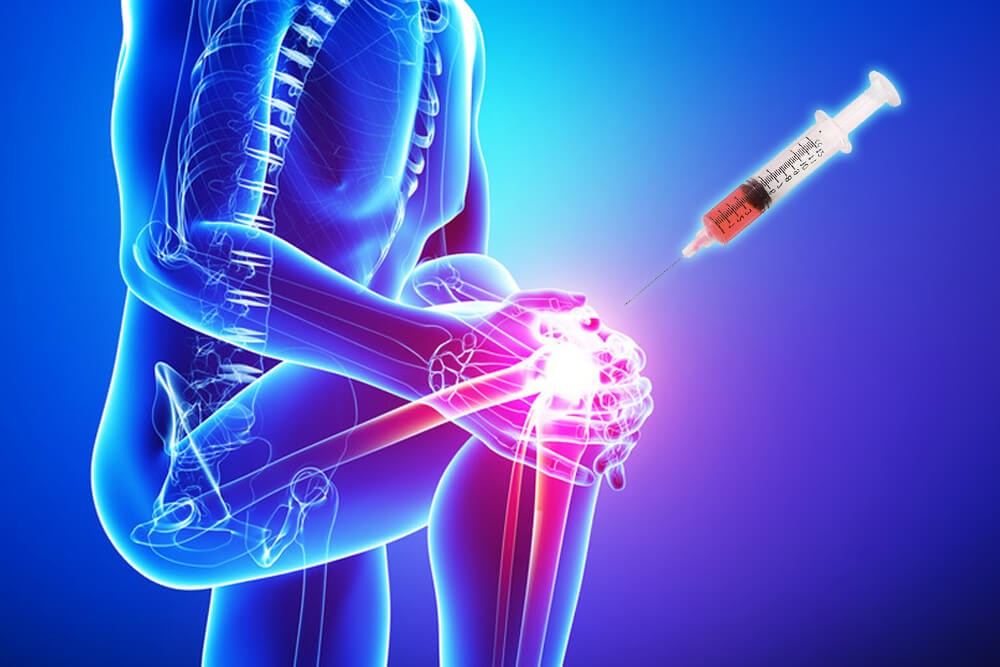 prp joint pain treatment ernakulam, kerala