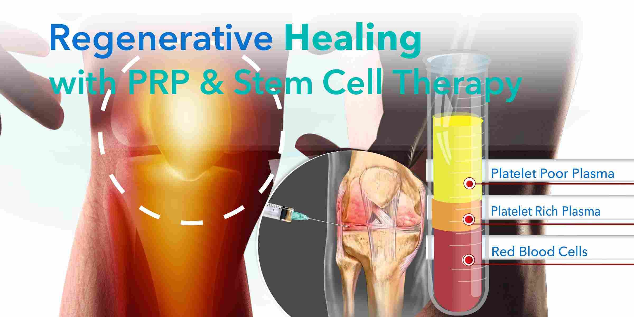 prp treatment kochi, thrissur, kerala, india