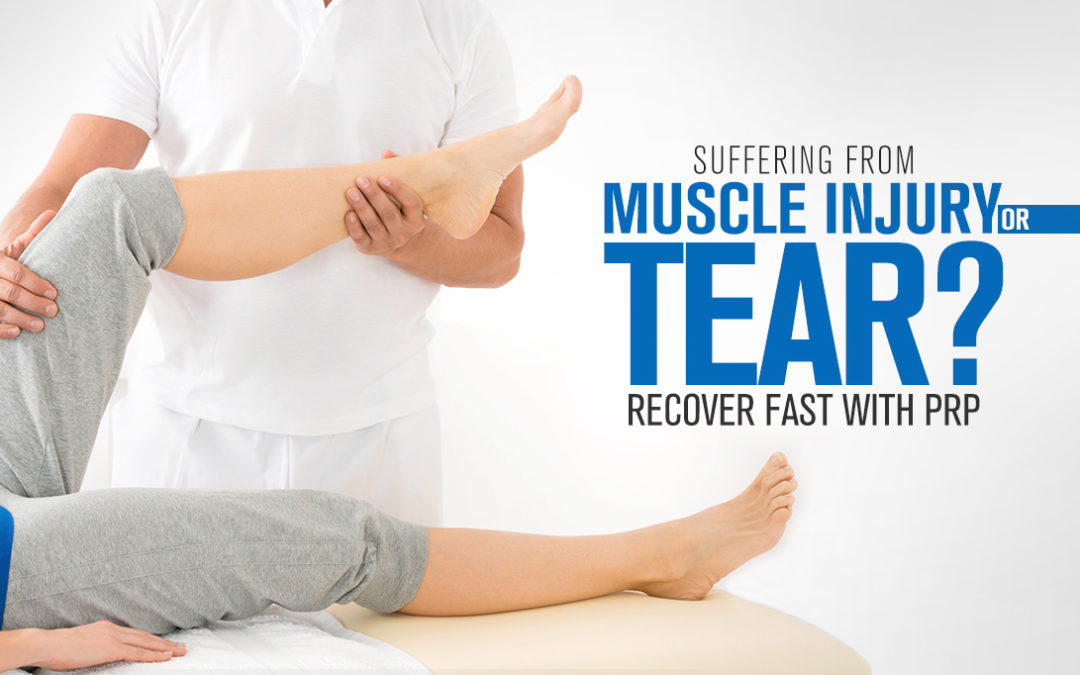 muscle sprain prp treatment kochi, ernakualm, kerala