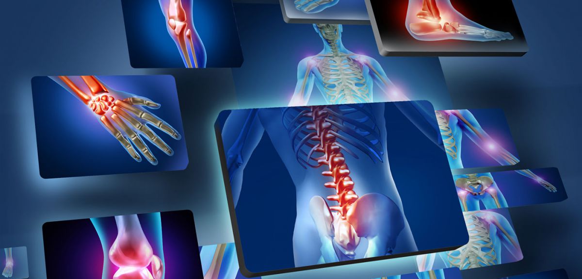 musculoskeletal pain prp therapy kochi, ernakulam, kerala