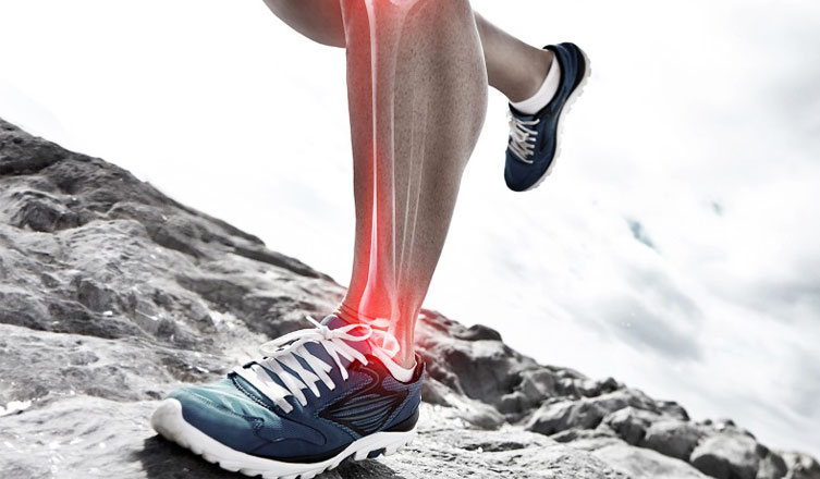 Shin Splints PRP Treatment in Ernakulam, Kerala, India